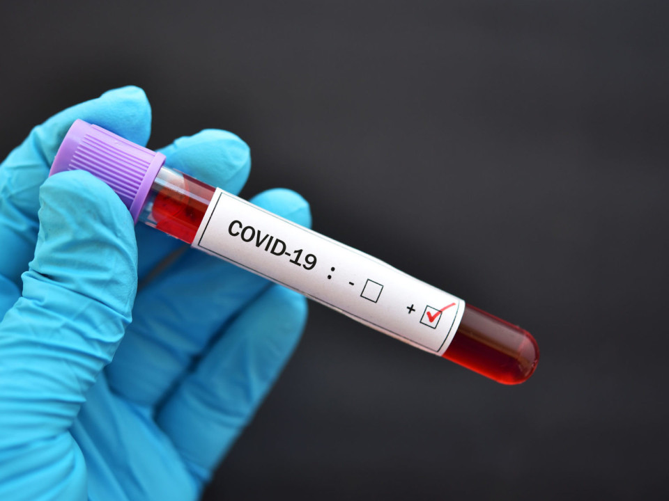Cercetătorii au adăugat noi simptome pe lista celor care indică infecția cu COVID-19!