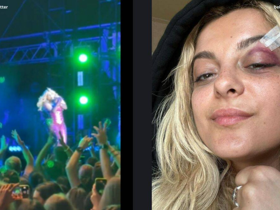 Bebe Rexha a primit un telefon în față în timpul unui concert din New York - cum și-a explicat gestul fanul supărat